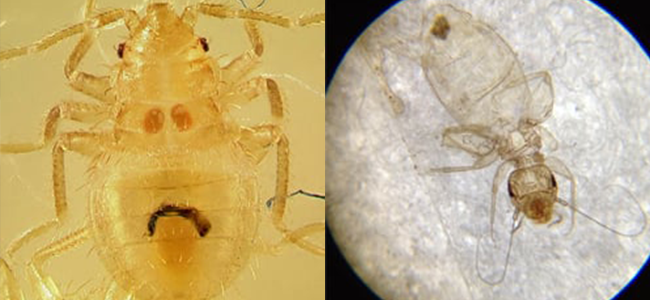 lice under microscope view