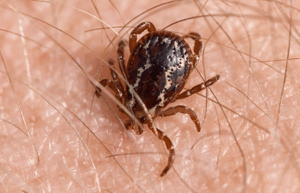 Tick biting skin