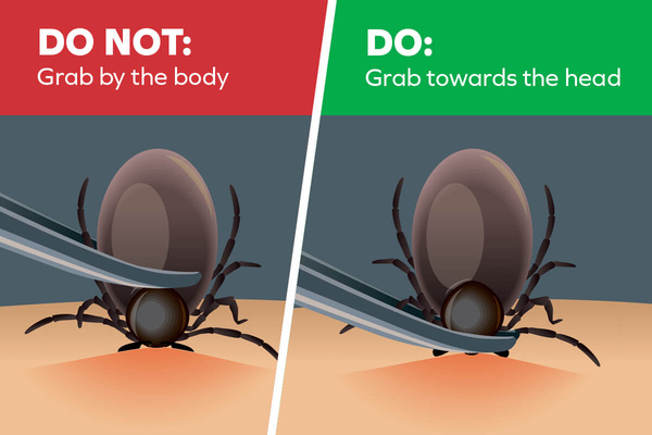 Image depicting the process of removing the dear at the head rather than the body