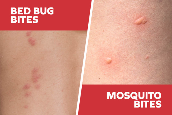 Diagram showing the differences between bed bugs bites and mosquito bites