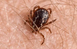 Tick biting skin