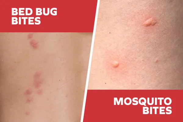 Diagram showing the differences between bed bugs bites and mosquito bites